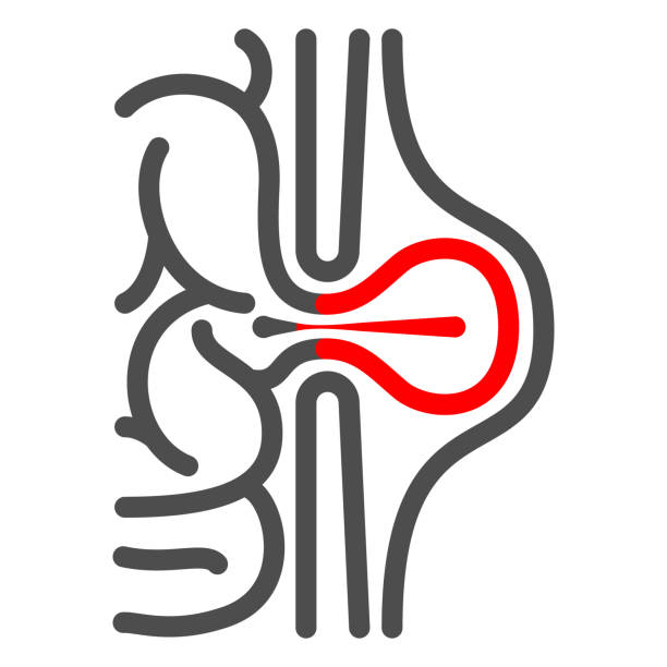 Inguinal Hernia