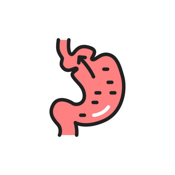 Epigastric Hernia